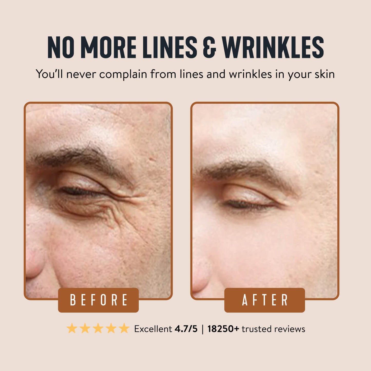 Wrinkle Defense Tallow Balm-td