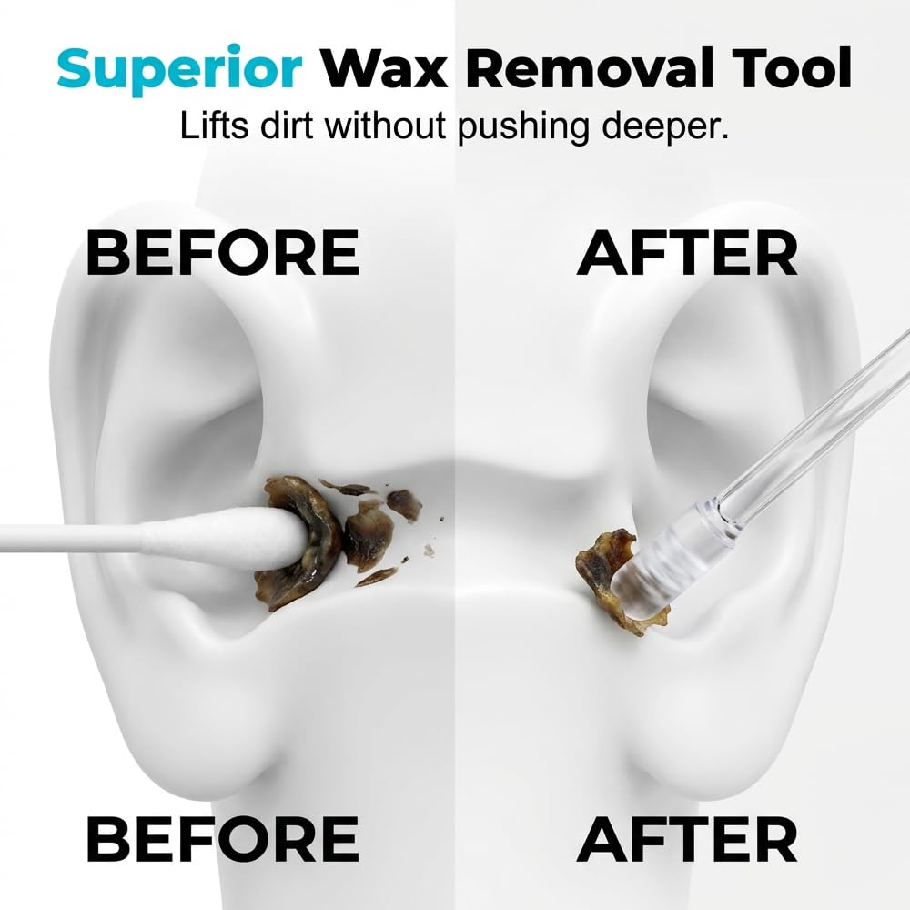 🥳2026 HOT SALE🥳💞50K+ SOLD!🧏‍♂️🌿Reusable Earwax Remover with Soft Adhesive Tip | 24pcs🤲💚