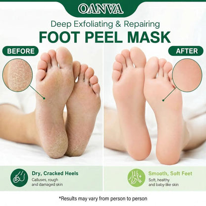 🎉2026 HOT SALE🎉💞50K+ SOLD! 🦶🌿Foot Peel Mask for Dry & Rough Feet | 60‑Minute Nourishing Foot Care 🙌💚