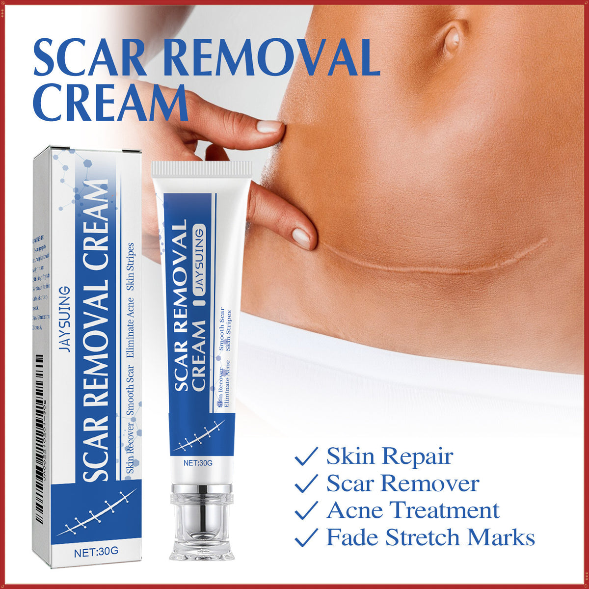 ✨Jaysuing Scar Removal Cream , Skin Repair Gel for Surgical Scars, Acne Marks, Stretch Marks, Burn &amp; Cut Scars, Odorless Skin Care Cream for Adults &amp; Kids