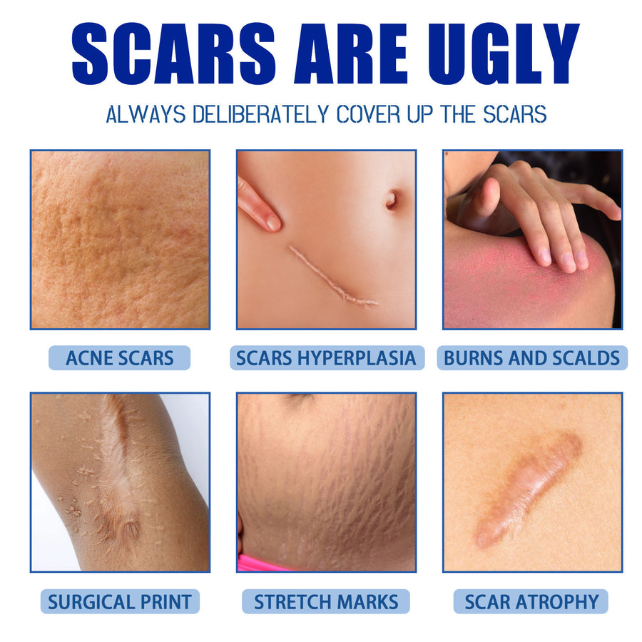Jaysuing scar cream product detail
