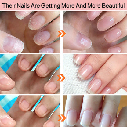 💜2026 New Upgraded 3-in-1 Nail Care Pen💅